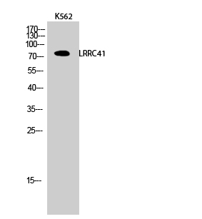 a30736 lrrc41 primary antibodies wb testing 2