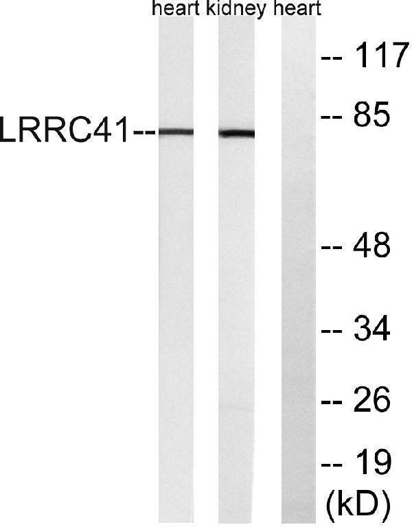 a30736 lrrc41 primary antibodies wb testing 4