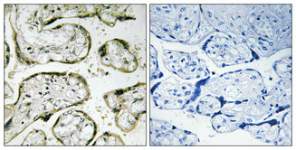 a30737 mrpl42 primary antibodies ihc testing 1