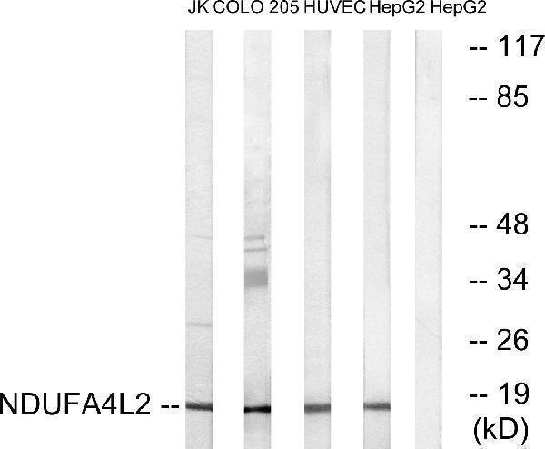 Western blot analysis of lysates from HepG2, HUVEC, COLO, and Jurkat cells, using NDUFA4L2 Antibody