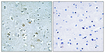 a30740 neurl1 primary antibodies ihc testing 1
