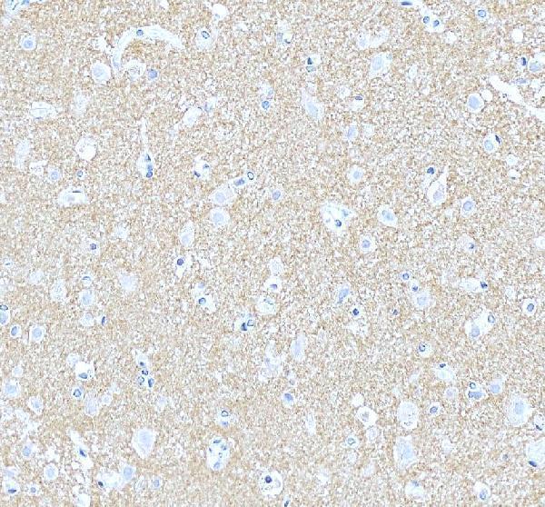 a30742 1 septin3 primary antibodies ihc testing 4