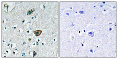 Immunohistochemical analysis of paraffin-embedded Human brain