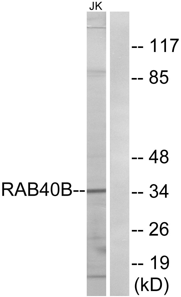 Western blot analysis of lysates from Jurkat cells, using RAB40B Antibody