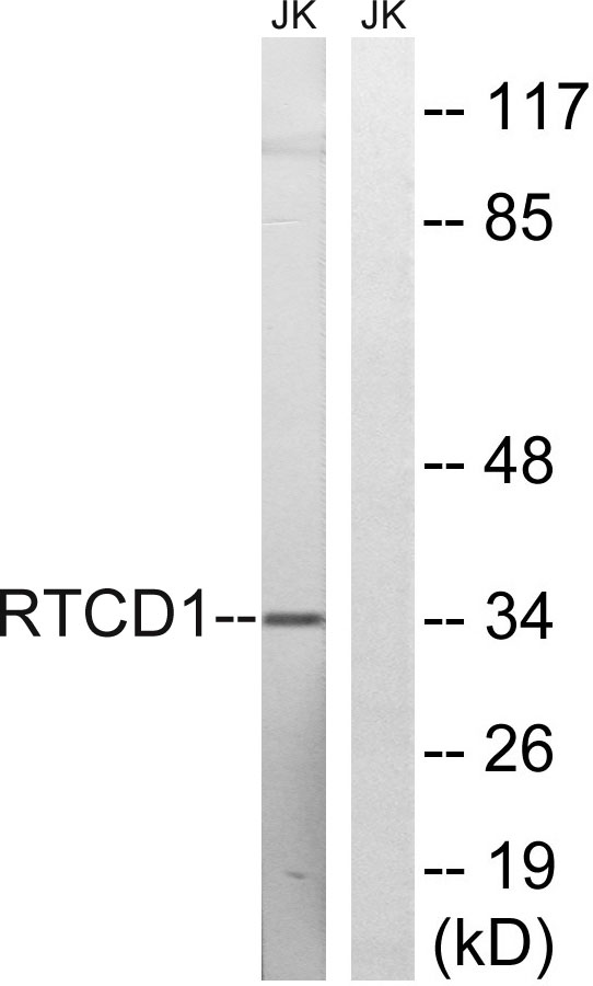 Western blot analysis of lysates from Jurkat cells, using RTCD1 Antibody