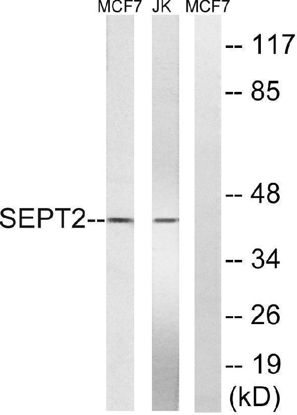 a30757 sept2 primary antibodies wb testing 2