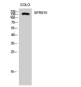 Western Blot analysis of COLO cells using SFRS15 Polyclonal Antibody diluted at 1:2000