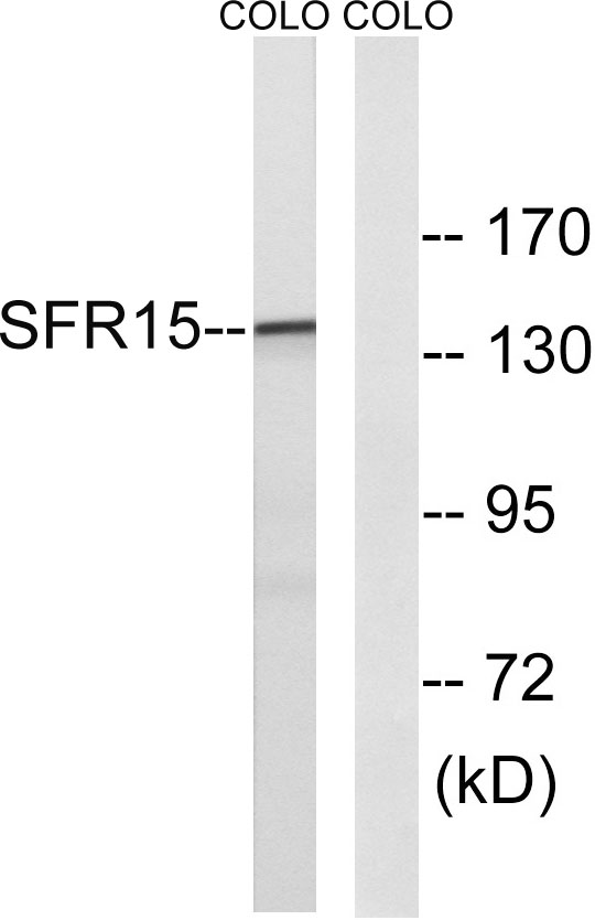Western blot analysis of lysates from COLO cells, using SFRS15 Antibody
