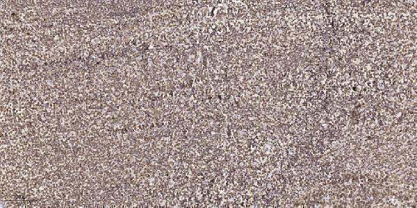 a30768 srsf7 primary antibodies ihc testing 1