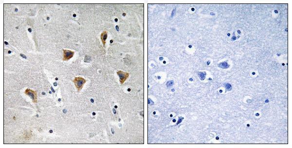 Immunohistochemistry analysis of paraffin-embedded human brain tissue, using MTERF Antibody