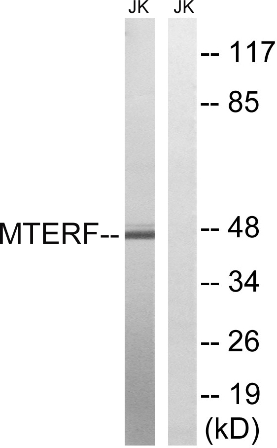 Western blot analysis of lysates from Jurkat cells, using MTERF Antibody