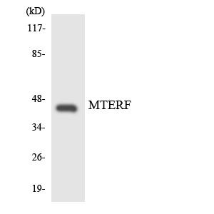 Western blot analysis of the lysates from HUVECcells using MTERF antibody