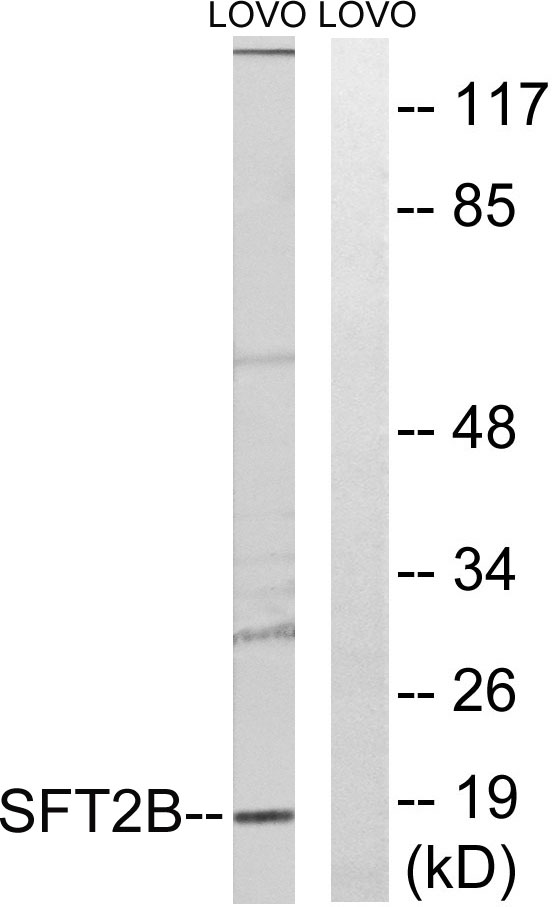 a30770 sft2d2 primary antibodies wb testing 2