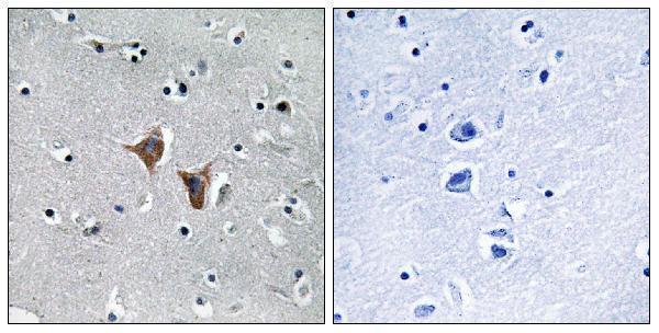 Immunohistochemistry analysis of paraffin-embedded human brain, using WASF4 Antibody