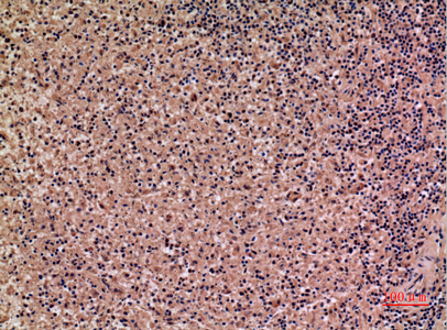 Immunohistochemical analysis of paraffin-embedded human-spleen, antibody was diluted at 1:100