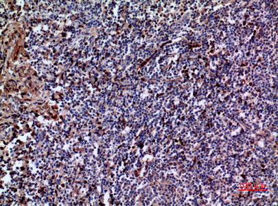 Immunohistochemical analysis of paraffin-embedded human-tonsil, antibody was diluted at 1:100