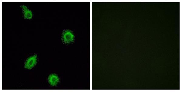 Immunofluorescence analysis of HUVEC cells, using HTR5B Antibody