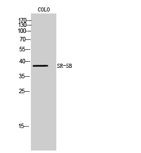 Western Blot analysis of COLO cells using SR-5B Polyclonal Antibody