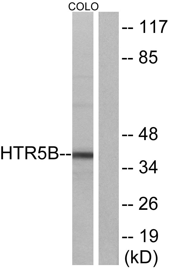 a30783 htr5b primary antibodies wb testing 3
