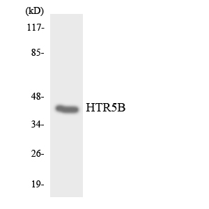 Western blot analysis of the lysates from HepG2 cells using HTR5B antibody