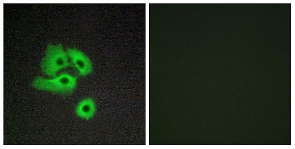 Immunofluorescence analysis of COS7 cells, using CCBP2 Antibody