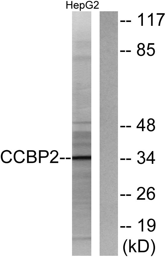 a30785 ackr2 primary antibodies wb testing 4