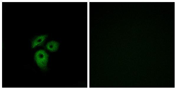 a30786 ackr1 primary antibodies if testing 1
