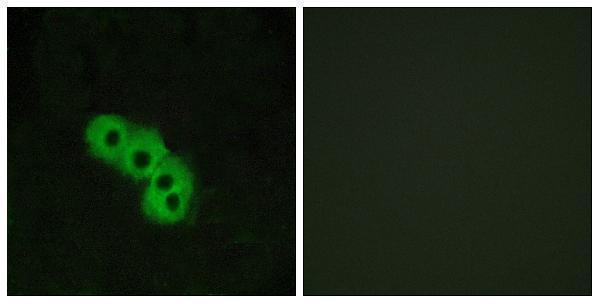 a30790 hcar3 primary antibodies if testing 1