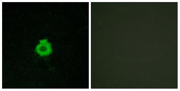 a30794 adgrb2 primary antibodies if testing 1