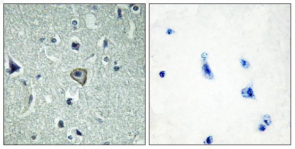 a30794 adgrb2 primary antibodies ihc testing 2