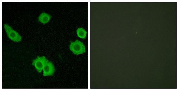 a30795 adgrb3 primary antibodies if testing 1