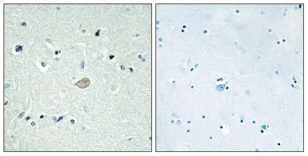 a30795 adgrb3 primary antibodies ihc testing 2