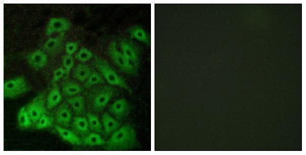 a30796 csrl1 primary antibodies if testing 1