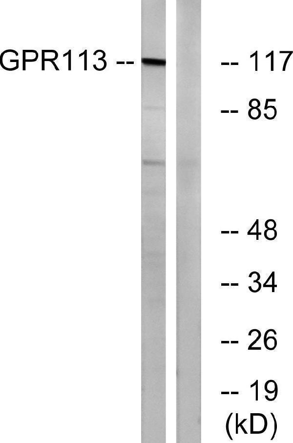 Western blot analysis of lysates from LOVO cells, using GPR113 Antibody