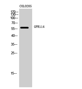 a30799 adgrg5 primary antibodies wb testing 1