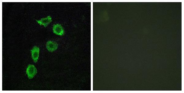 a30801 adgra1 primary antibodies if testing 1