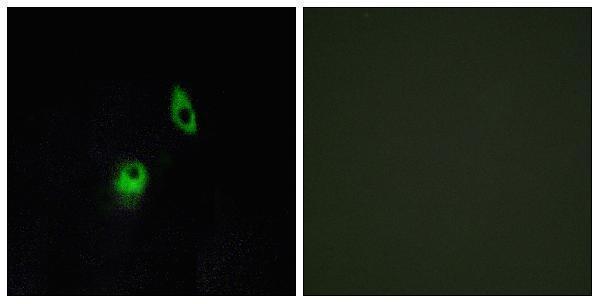 a30802 adgra2 primary antibodies if testing 1