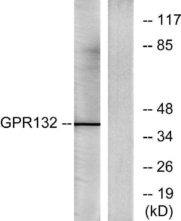 Western blot analysis of lysates from Jurkat cells, using GPR132 Antibody