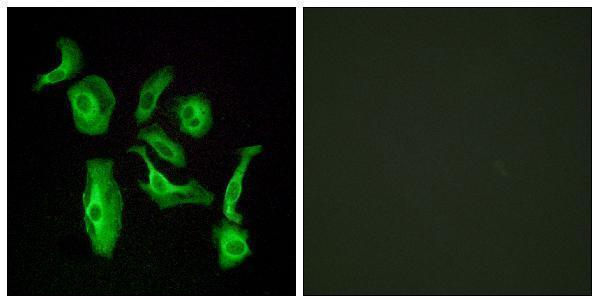 a30805 adgrd1 primary antibodies if testing 1