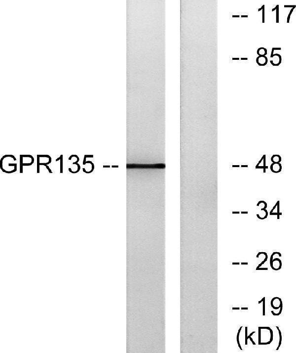 Western blot analysis of lysates from NIH/3T3 cells, using GPR135 Antibody