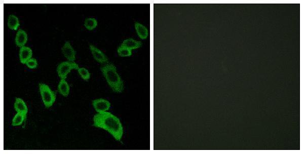 a30807 gpr139 primary antibodies if testing 1