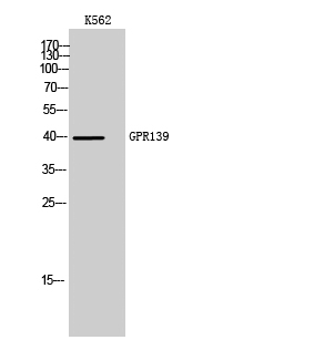 a30807 gpr139 primary antibodies wb testing 2