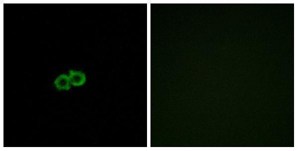a30808 gpr142 primary antibodies if testing 1