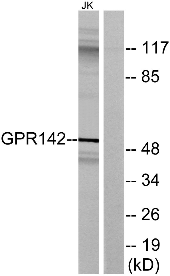 a30808 gpr142 primary antibodies wb testing 2