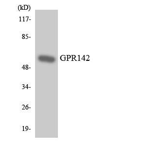 a30808 gpr142 primary antibodies wb testing 3