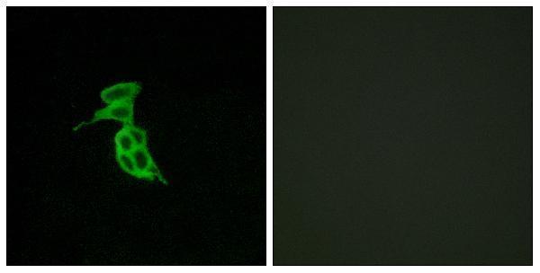 a30809 gpr143 primary antibodies if testing 1