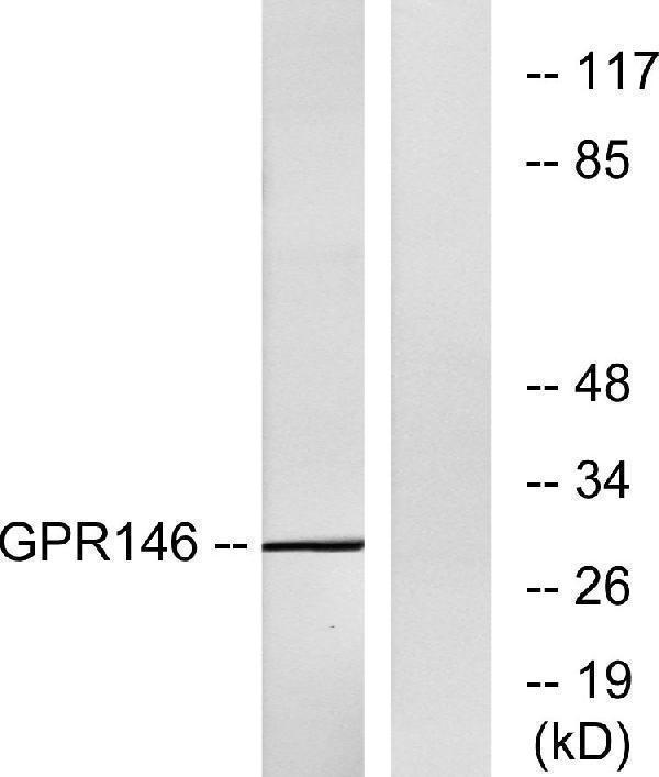 Western blot analysis of lysates from LOVO cells, using GPR146 Antibody
