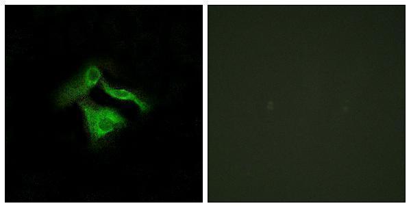 a30812 gpr149 primary antibodies if testing 1