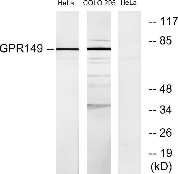 a30812 gpr149 primary antibodies wb testing 2