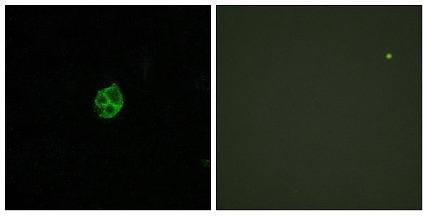 a30814 gpr151 primary antibodies if testing 1